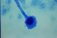 A sample of Aspergillus fumigatus, the first fungus diagnosed in the fungal meningitis outbreak sweeping the United States, in Nashville, Tennessee